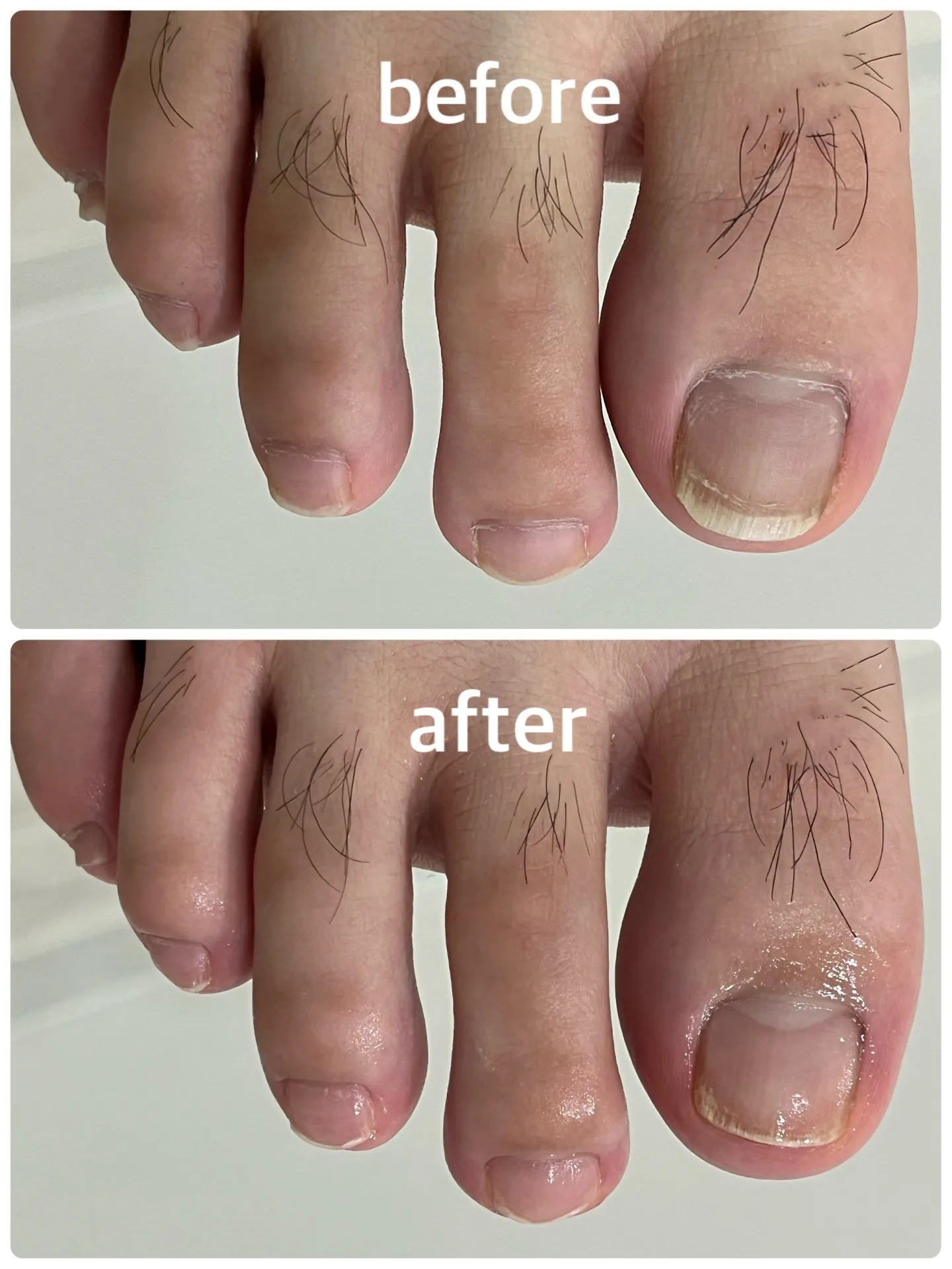 【ネイルケア Before → After】